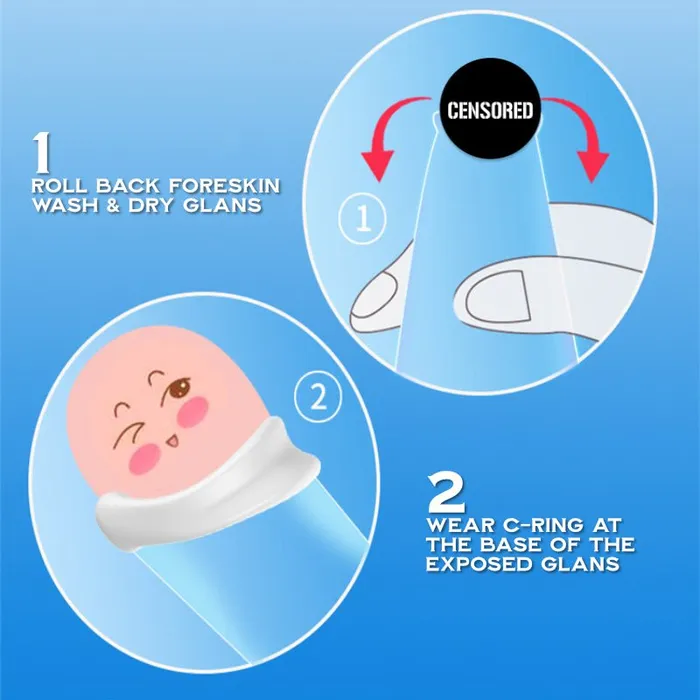 Male Sex Toys FRISKY BUSINESS SG Cock CRing Foreskin Correction Device
